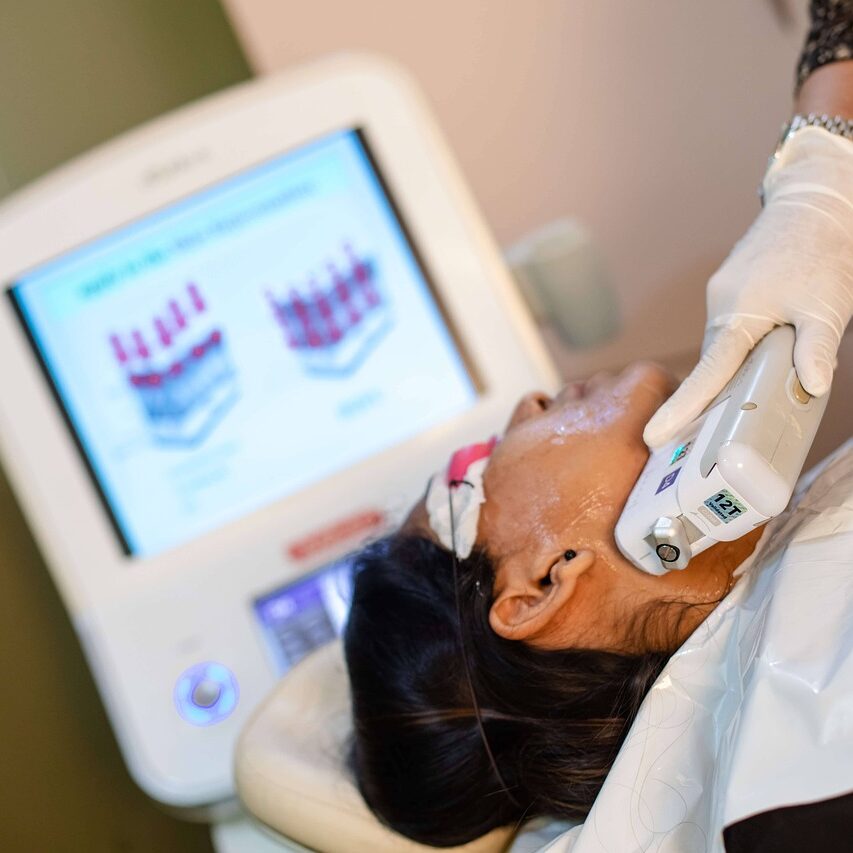 ヒゲの医療レーザー脱毛・157（201-260）